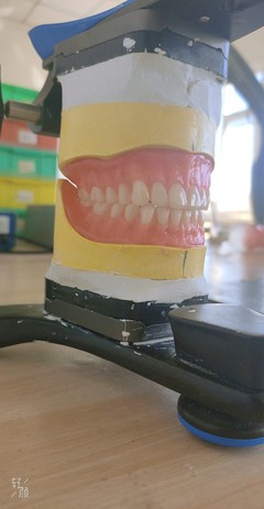 沈陽沈陽附近中高端功能吸附性義齒上門全套,活動義齒代加工,注塑槍_沈陽收藏品/工藝品